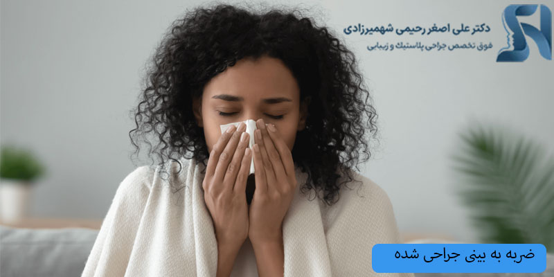 ضربه-به-بینی
