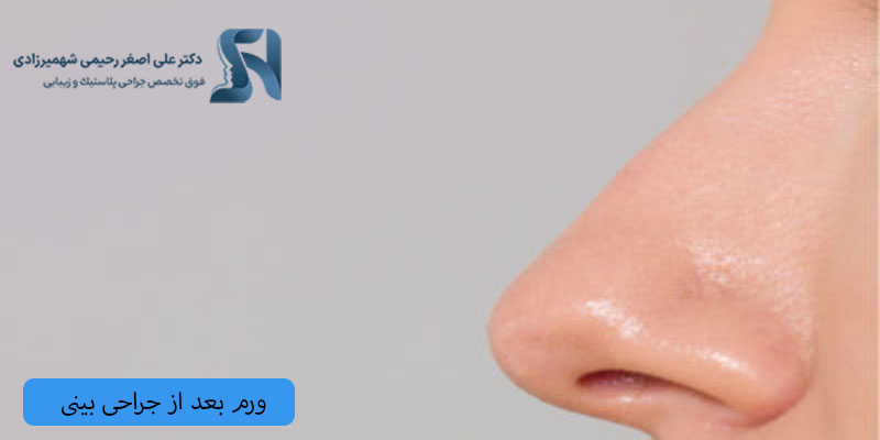ورم-بینی-بعد-از-جراحی