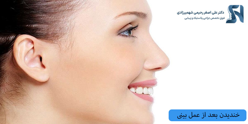 خندیدن-بعد-از-عمل-بینی