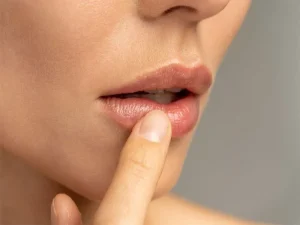 بی-حسی-لب-ها بعد از عمل بینی