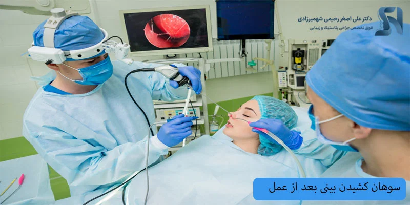 سوهان-کشیدن-بینی-بعد-از-عمل