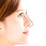جراحی بزرگ کردن بینی