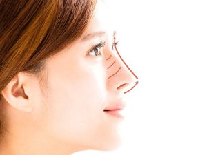 جراحی بزرگ کردن بینی