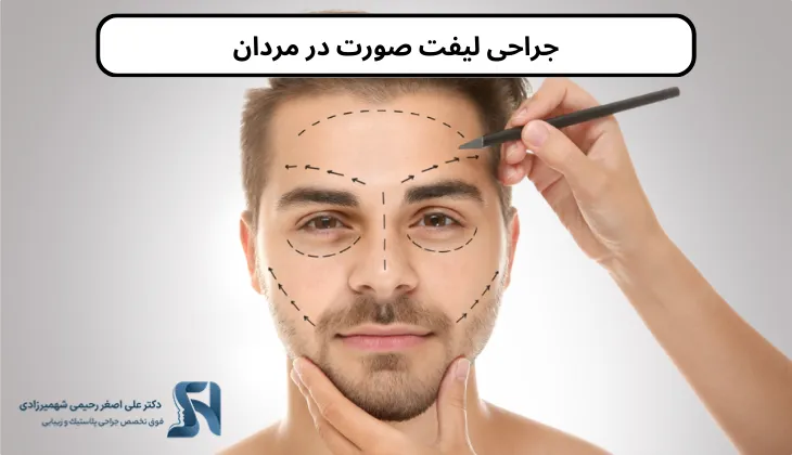 جراحی لیفت صورت در مردان