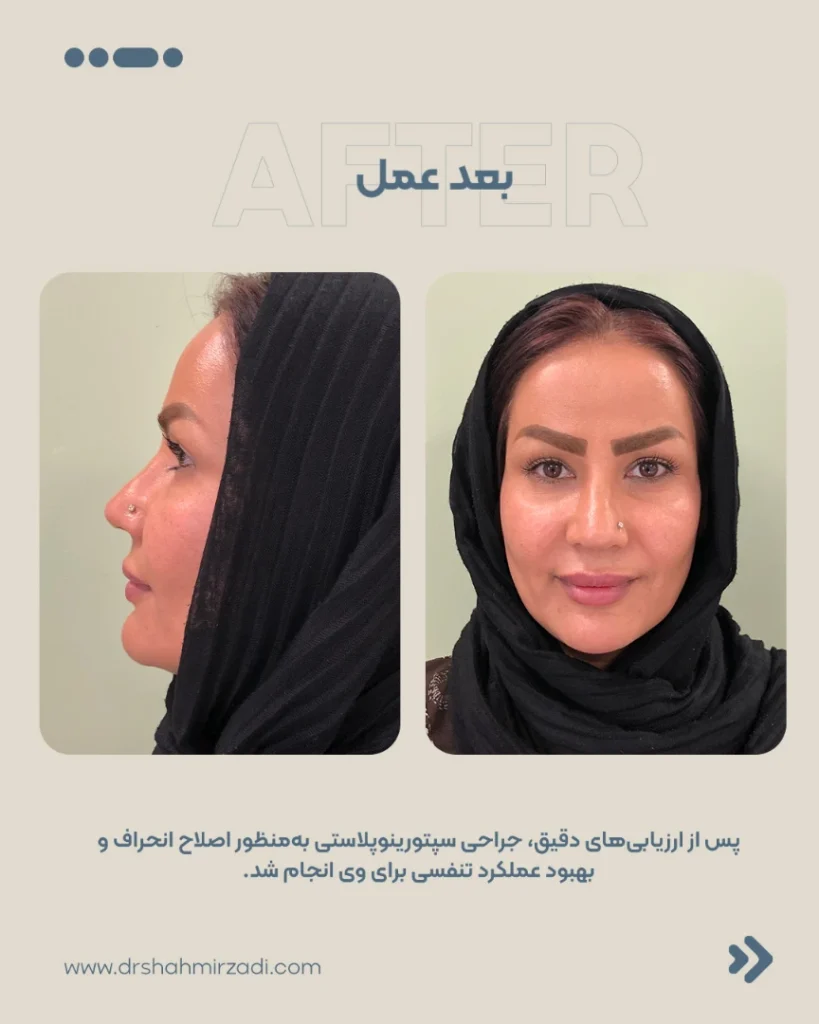 client3 03